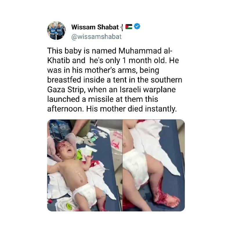 A social media post by Wissan Shabat contains two medical photos showing an injured, crying infant in a diaper lying on an examination table with visible wounds on the head and leg.