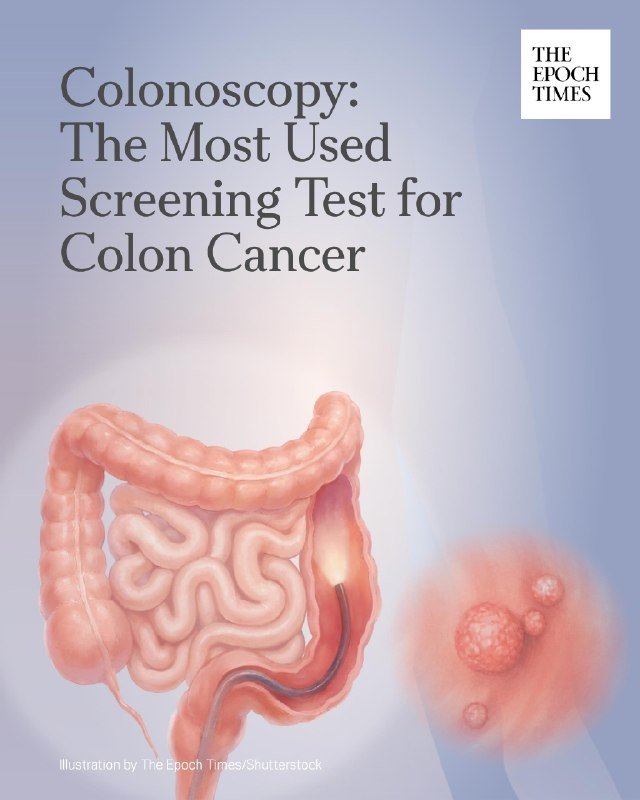 A medical illustration titled "Colonoscopy: The Most Used Screening Test for Colon Cancer" depicts an endoscope inserted into a colon alongside a magnified view of polyps.