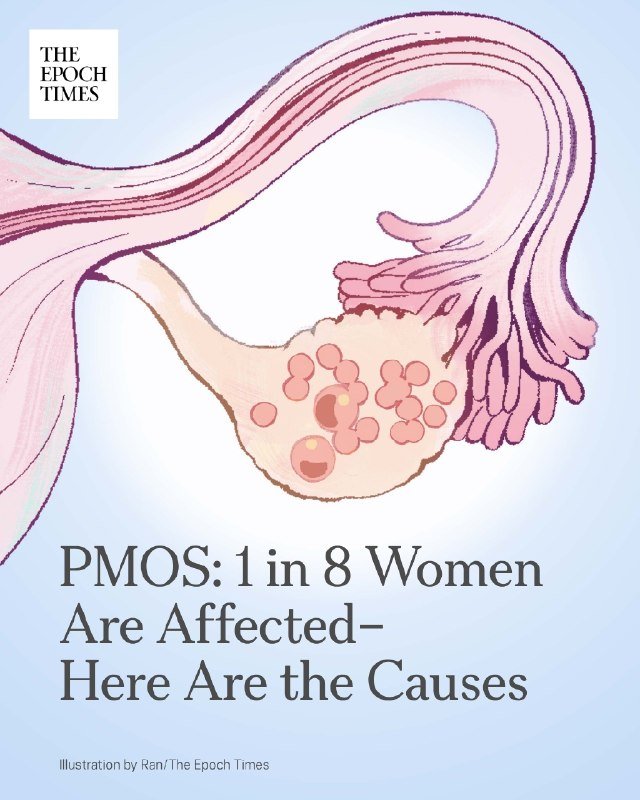 Illustration of a pink-toned ovary with follicular cysts beside a fallopian tube, titled "PMOS: 1 in 8 Women Are Affected–Here Are the Causes," credited to The Epoch Times.