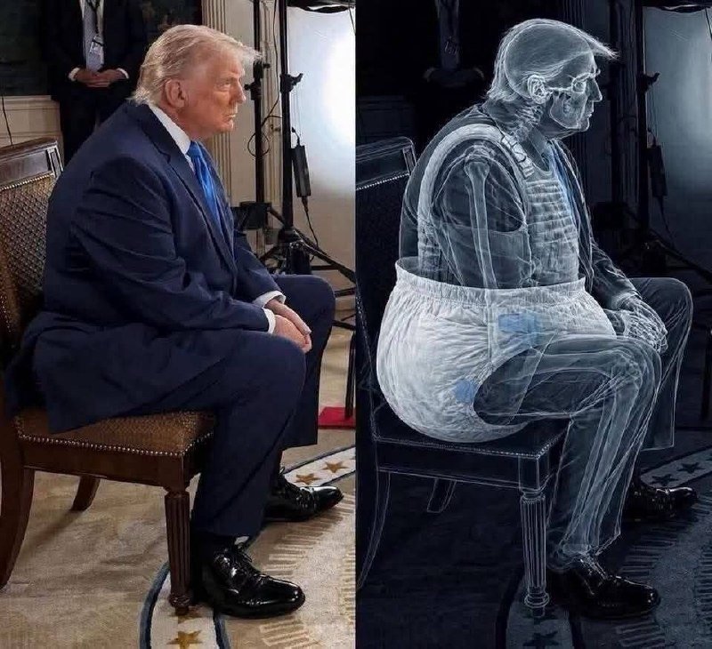 A side-by-side composite shows a man in a dark suit seated in a chair, paired with an X-ray image revealing an adult diaper beneath his clothing.