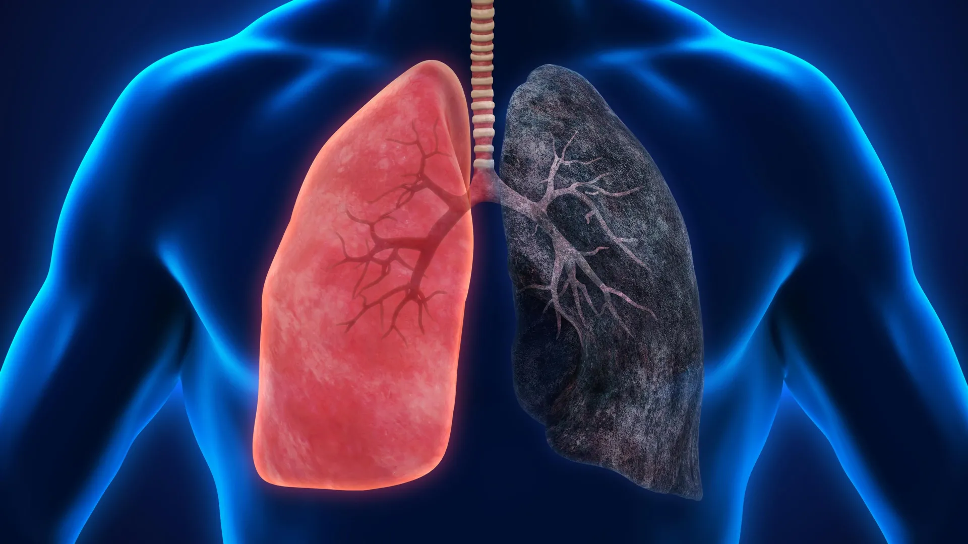 Epidemiologists are converging on a finding that long-run heavy cannabis smokers face measurably higher odds of lung, head and neck cancers, even as dosage thresholds and confounders remain unresolved.