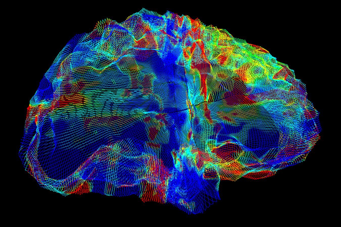 A digital wireframe rendering of a human brain displays multicolored grid lines in red, yellow, green, and blue against a black background.