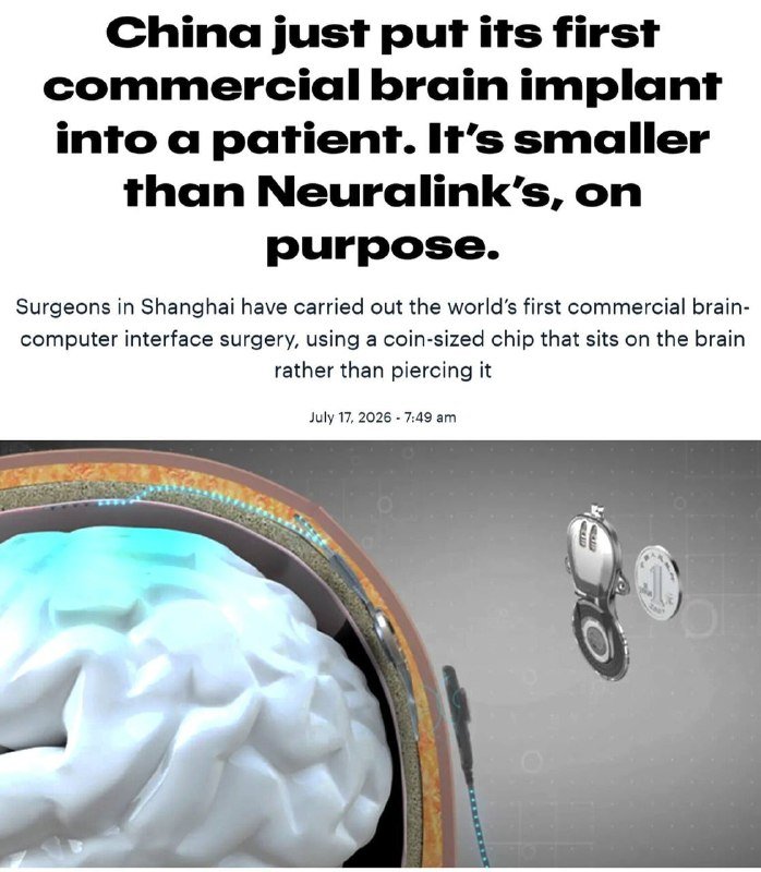 A news headline and subheading about China's first commercial brain implant sit above an illustration of a small disc-shaped chip being implanted onto a glowing human brain.